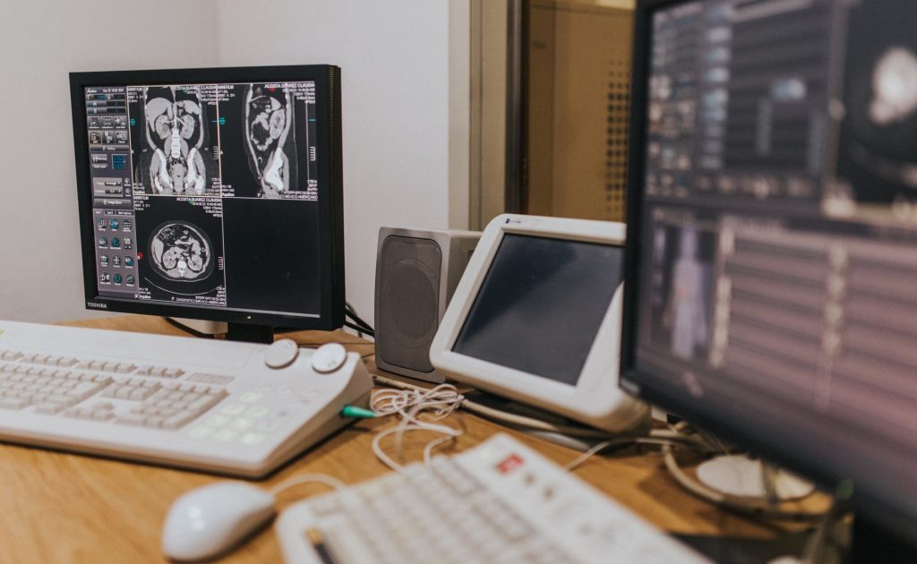 medical imaging equipment displaying scans on multiple monitors