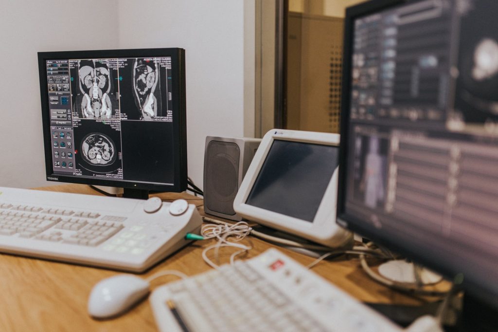 medical imaging equipment displaying scans on multiple monitors