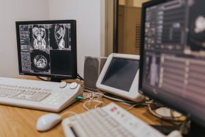 medical imaging equipment displaying scans on multiple monitors